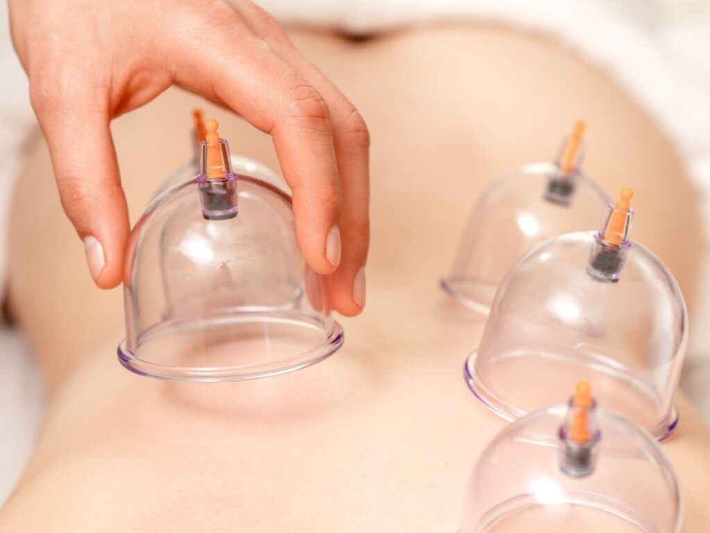 A woman's breasts are being treated with plastic cups.
